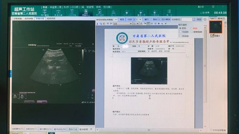 婚检，何时开始最宜？**